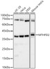 Western blot analysis of various lysates, using MTHFD2 antibody (CAB22653) at 1:7000 dilution. Secondary antibody: HRP Goat Anti-Rabbit IgG (H+L) at 1:10000 dilution. Lysates/proteins: 25μg per lane. Blocking buffer: 3% nonfat dry milk in TBST.