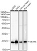 Western blot analysis of various lysates, using MFAP5 antibody (CAB22675) at 1:900 dilution. Secondary antibody: HRP Goat Anti-Rabbit IgG (H+L) at 1:10000 dilution. Lysates/proteins: 25μg per lane. Blocking buffer: 3% nonfat dry milk in TBST.