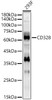 Western blot analysis of 293F, using CD328 antibody (CAB22679) at 1:1000 dilution. Secondary antibody: HRP Goat Anti-Rabbit IgG (H+L) at 1:10000 dilution. Lysates/proteins: 25μg per lane. Blocking buffer: 3% nonfat dry milk in TBST.
