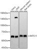 Western blot analysis of various lysates, using INTS11 antibody (CAB22698) at 1:6000 dilution. Secondary antibody: HRP Goat Anti-Rabbit IgG (H+L) at 1:10000 dilution. Lysates/proteins: 25μg per lane. Blocking buffer: 3% nonfat dry milk in TBST.