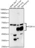 Western blot analysis of various lysates, using FceR1 alpha antibody (CAB22729) at 1:6000 dilution. Secondary antibody: HRP Goat Anti-Rabbit IgG (H+L) at 1:10000 dilution. Lysates/proteins: 25μg per lane. Blocking buffer: 3% nonfat dry milk in TBST.