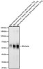Western blot analysis of Recombinant Mouse IFN-beta Protein (RP01076，C-hFc&His taged), using IFN-beta antibody (CAB22740) at 1:6000 dilution. Secondary antibody: HRP Goat Anti-Rabbit IgG (H+L) at 1:10000 dilution. Lysates/proteins: 25μg per lane. Blocking buffer: 3% nonfat dry milk in TBST.