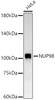 Western blot analysis of HeLa, using NUP98 antibody (CAB22743) at 1:6000 dilution. Secondary antibody: HRP Goat Anti-Rabbit IgG (H+L) at 1:10000 dilution. Lysates/proteins: 25μg per lane. Blocking buffer: 3% nonfat dry milk in TBST.