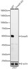 Western blot analysis of extracts from wild type(WT) and Smad5 knockout (KO) 293T(KO) cells, using Smad5 antibody (CAB22749) at 1:1000 dilution. Secondary antibody: HRP Goat Anti-Rabbit IgG (H+L) at 1:10000 dilution. Lysates/proteins: 25μg per lane. Blocking buffer: 3% nonfat dry milk in TBST.