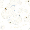 Immunohistochemistry analysis of paraffin-embedded human placenta using CD66b/CEACAM8 Rabbit mAb (CAB22753) at dilution of 1:1000 (40x lens). Perform high pressure antigen retrieval with 10 mM citrate buffer pH 6. 0 before commencing with IHC staining protocol.
