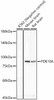 Western blot analysis of various lysates, using PDE10A antibody (CAB22757) at 1:1000 dilution. Secondary antibody: HRP Goat Anti-Rabbit IgG (H+L) at 1:10000 dilution. Lysates/proteins: 25μg per lane. Blocking buffer: 3% nonfat dry milk in TBST.