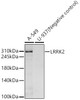Western blot analysis of various lysates, using LRRK2 Rabbit mAb (CAB22759) at 1:500 dilution. Secondary antibody: HRP Goat Anti-Rabbit IgG (H+L) at 1:10000 dilution. Lysates/proteins: 25μg per lane. Blocking buffer: 3% nonfat dry milk in TBST.