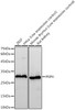 Western blot analysis of various lysates, using PSPH antibody (CAB22763) at 1:10000 dilution. Secondary antibody: HRP Goat Anti-Rabbit IgG (H+L) at 1:10000 dilution. Lysates/proteins: 25μg per lane. Blocking buffer: 3% nonfat dry milk in TBST.