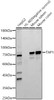 Western blot analysis of various lysates, using TAP1 antibody (CAB22769) at 1:10000 dilution. Secondary antibody: HRP Goat Anti-Rabbit IgG (H+L) at 1:10000 dilution. Lysates/proteins: 25μg per lane. Blocking buffer: 3% nonfat dry milk in TBST.