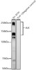 Western blot analysis of various lysates, using ALK antibody (CAB22791) at 1:2000 dilution. Secondary antibody: HRP Goat Anti-Rabbit IgG (H+L) at 1:10000 dilution. Lysates/proteins: 25μg per lane. Blocking buffer: 3% nonfat dry milk in TBST.