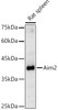 Western blot analysis of Rat spleen, using Aim2 antibody (CAB22874) at 1:1000 dilution. Secondary antibody: HRP Goat Anti-Rabbit IgG (H+L) at 1:10000 dilution. Lysates/proteins: 25μg per lane. Blocking buffer: 3% nonfat dry milk in TBST.