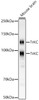 Western blot analysis of Mouse brain, using TrKC antibody (CAB23002) at 1:1000 dilution. Secondary antibody: HRP Goat Anti-Rabbit IgG (H+L) at 1:10000 dilution. Lysates/proteins: 25μg per lane. Blocking buffer: 3% nonfat dry milk in TBST.