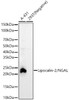Western blot analysis of various lysates, using Lipocalin-2/NGAL antibody (CAB23033) at 1:5000 dilution. Secondary antibody: HRP Goat Anti-Rabbit IgG (H+L) at 1:10000 dilution. Lysates/proteins: 25μg per lane. Blocking buffer: 3% nonfat dry milk in TBST.