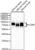 Western blot analysis of various lysates, using CD98 antibody (CAB23051) at 1:1000 dilution. Secondary antibody: HRP Goat Anti-Rabbit IgG (H+L) at 1:10000 dilution. Lysates/proteins: 25μg per lane. Blocking buffer: 3% nonfat dry milk in TBST.
