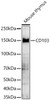 Western blot analysis of Mouse thymus, using CD103 Rabbit pAb (CAB23053) at 1:900 dilution. Secondary antibody: HRP Goat Anti-Rabbit IgG (H+L) at 1:10000 dilution. Lysates/proteins: 25ug per lane. Blocking buffer: 3% nonfat dry milk in TBST.