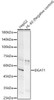 Western blot analysis of various lysates, using DGAT1 antibody (CAB23077) at 1:1000 dilution. Secondary antibody: HRP Goat Anti-Rabbit IgG (H+L) at 1:10000 dilution. Lysates/proteins: 25μg per lane. Blocking buffer: 3% nonfat dry milk in TBST.