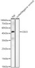 Western blot analysis of various lysates, using CD23 antibody (CAB23092) at 1:1000 dilution. Secondary antibody: HRP Goat Anti-Rabbit IgG (H+L) at 1:10000 dilution. Lysates/proteins: 25μg per lane. Blocking buffer: 3% nonfat dry milk in TBST.