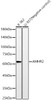 Western blot analysis of various lysates, using AMHR2 antibody (CAB23122) at 1:2000 dilution. Secondary antibody: HRP Goat Anti-Rabbit IgG (H+L) at 1:10000 dilution. Lysates/proteins: 25μg per lane. Blocking buffer: 3% nonfat dry milk in TBST.