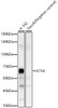 Western blot analysis of various lysates, using ETV4 antibody (CAB23126) at 1:8000 dilution. Secondary antibody: HRP Goat Anti-Rabbit IgG (H+L) at 1:10000 dilution. Lysates/proteins: 25μg per lane. Blocking buffer: 3% nonfat dry milk in TBST.