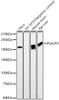 Western blot analysis of various lysates, using PLA2R1 antibody (CAB23148) at 1:900 dilution. Secondary antibody: HRP Goat Anti-Rabbit IgG (H+L) at 1:10000 dilution. Lysates/proteins: 25μg per lane. Blocking buffer: 3% nonfat dry milk in TBST.