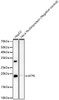 Western blot analysis of various lysates, using ATP6 antibody (CAB23150) at 1:2000 dilution. Secondary antibody: HRP Goat Anti-Rabbit IgG (H+L) at 1:10000 dilution. Lysates/proteins: 25μg per lane. Blocking buffer: 3% nonfat dry milk in TBST.
