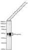 Western blot analysis of Recombinant Rat IFN-gamma Protein, using IFN gamma antibody (CAB23152) at 1:1000 dilution. Secondary antibody: HRP Goat Anti-Rabbit IgG (H+L) at 1:10000 dilution. Lysates/proteins: 1ng/0. 5ng per lane. Blocking buffer: 3% nonfat dry milk in TBST.