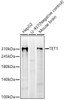 Western blot analysis of various lysates, using TET1 antibody (CAB23162) at 1:1000 dilution. Secondary antibody: HRP Goat Anti-Rabbit IgG (H+L) at 1:10000 dilution. Lysates/proteins: 25μg per lane. Blocking buffer: 3% nonfat dry milk in TBST.