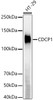 Western blot analysis of HT-29, using CDCP1 Rabbit mAb (CAB23178) at 1:2000 dilution. Secondary antibody: HRP Goat Anti-Rabbit IgG (H+L) at 1:10000 dilution. Lysates/proteins: 25μg per lane. Blocking buffer: 3% nonfat dry milk in TBST.