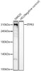 Western blot analysis of various lysates, using ITPR3 Rabbit mAb (CAB23202) at 1:5000 dilution. Secondary antibody: HRP Goat Anti-Rabbit IgG (H+L) at 1:10000 dilution. Lysates/proteins: 25μg per lane. Blocking buffer: 3% nonfat dry milk in TBST.