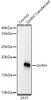 Western blot analysis of 293T-GHRH-his, using GHRH Rabbit mAb (CAB23232) at 1:1000 dilution. Secondary antibody: HRP Goat Anti-Rabbit IgG (H+L) at 1:10000 dilution. Lysates/proteins: 25μg per lane. Blocking buffer: 3% nonfat dry milk in TBST.