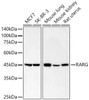 Western blot analysis of various lysates, using RARG Rabbit mAb (CAB23233) at 1:1000 dilution. Secondary antibody: HRP Goat Anti-Rabbit IgG (H+L) at 1:10000 dilution. Lysates/proteins: 25μg per lane. Blocking buffer: 3% nonfat dry milk in TBST.