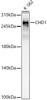 Western blot analysis of extracts from K-562 cells, using CHD1 Rabbit mAb (CAB23240) at 1:1000 dilution. Secondary antibody: HRP Goat Anti-Rabbit IgG (H+L) at 1:10000 dilution. Lysates/proteins: 25μg per lane. Blocking buffer: 3% nonfat dry milk in TBST.