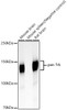 Western blot analysis of various lysates, using pan-Trk Rabbit mAb (CAB23241) at 1:1000 dilution. Secondary antibody: HRP Goat Anti-Rabbit IgG (H+L) at 1:10000 dilution. Lysates/proteins: 25μg per lane. Blocking buffer: 3% nonfat dry milk in TBST.