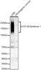 Western blot analysis of various lysates, using CD138/Syndecan-1 Rabbit mAb (CAB23249) at 1:1000 dilution. Secondary antibody: HRP Goat Anti-Rabbit IgG (H+L) at 1:10000 dilution. Lysates/proteins: 25μg per lane. Blocking buffer: 3% nonfat dry milk in TBST.