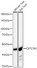 Western blot analysis of various lysates, using CYP27A1 Rabbit mAb (CAB23250) at 1:5000 dilution. Secondary antibody: HRP Goat Anti-Rabbit IgG (H+L) at 1:10000 dilution. Lysates/proteins: 25μg per lane. Blocking buffer: 3% nonfat dry milk in TBST.
