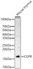Western blot analysis of Mouse thymus, using CGPR Rabbit pAb (CAB23252) at 1:400 dilution. Secondary antibody: HRP Goat Anti-Rabbit IgG (H+L) at 1:10000 dilution. Lysates/proteins: 25μg per lane. Blocking buffer: 3% nonfat dry milk in TBST.