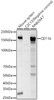 Western blot analysis of various lysates, using CD11b Rabbit pAb (CAB23254) at 1:2000 dilution. Secondary antibody: HRP Goat Anti-Rabbit IgG (H+L) at 1:10000 dilution. Lysates/proteins: 25μg per lane. Blocking buffer: 3% nonfat dry milk in TBST.