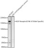 Western blot analysis of various lysates, using EGF Receptor (E746-A750del Specific) Rabbit pAb (CAB23256) at 1:400 dilution. Secondary antibody: HRP Goat Anti-Rabbit IgG (H+L) at 1:10000 dilution. Lysates/proteins: 25μg per lane. Blocking buffer: 3% nonfat dry milk in TBST.