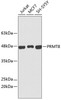 Western blot analysis of extracts of various cell lines, using PRMT8 antibody (CAB2326). Secondary antibody: HRP Goat Anti-Rabbit IgG (H+L) at 1:10000 dilution. Lysates/proteins: 25μg per lane. Blocking buffer: 3% nonfat dry milk in TBST.