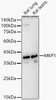 Western blot analysis of various lysates, using MKP1 Rabbit pAb (CAB23261) at 1:2000 dilution. Secondary antibody: HRP Goat Anti-Rabbit IgG (H+L) at 1:10000 dilution. Lysates/proteins: 25μg per lane. Blocking buffer: 3% nonfat dry milk in TBST.