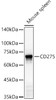 Western blot analysis of Mouse spleen, using CD275 Rabbit pAb (CAB23266) at 1:1500 dilution. Secondary antibody: HRP Goat Anti-Rabbit IgG (H+L) at 1:10000 dilution. Lysates/proteins: 25μg per lane. Blocking buffer: 3% nonfat dry milk in TBST.