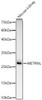 Western blot analysis of Mouse kidney, using METRNL Rabbit pAb (CAB23269) at 1:1000 dilution. Secondary antibody: HRP Goat Anti-Rabbit IgG (H+L) at 1:10000 dilution. Lysates/proteins: 25μg per lane. Blocking buffer: 3% nonfat dry milk in TBST.