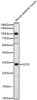 Western blot analysis of Mouse skeletal muscle, using UCP3 Rabbit mAb (CAB23285) at 1:1000 dilution. Secondary antibody: HRP Goat Anti-Rabbit IgG (H+L) at 1:10000 dilution. Lysates/proteins: 25μg per lane. Blocking buffer: 3% nonfat dry milk in TBST.