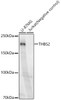 Western blot analysis of various lysates, using THBS2 Rabbit mAb (CAB23296) at 1:1000 dilution. Secondary antibody: HRP Goat Anti-Rabbit IgG (H+L) at 1:10000 dilution. Lysates/proteins: 25μg per lane. Blocking buffer: 3% nonfat dry milk in TBST.