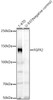 Western blot analysis of various lysates, using FGFR2 Rabbit mAb (CAB23298) at 1:1000 dilution. Secondary antibody: HRP Goat Anti-Rabbit IgG (H+L) at 1:10000 dilution. Lysates/proteins: 25μg per lane. Blocking buffer: 3% nonfat dry milk in TBST.
