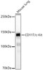 Western blot analysis of extracts from mouse lung, using CD117/c-Kit Rabbit mAb (CAB23299) at 1:1000 dilution. Secondary antibody: HRP Goat Anti-Rabbit IgG (H+L) at 1:10000 dilution. Lysates/proteins: 25μg per lane. Blocking buffer: 3% nonfat dry milk in TBST.