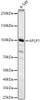 Western blot analysis of A-549, using APLP1 Rabbit mAb (CAB23426) at 1:1000 dilution. Secondary antibody: HRP Goat Anti-Rabbit IgG (H+L) at 1:10000 dilution. Lysates/proteins: 25μg per lane. Blocking buffer: 3% nonfat dry milk in TBST.