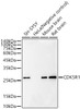 Western blot analysis of various lysates, using CDK5R1 Rabbit mAb (CAB23427) at 1:5000 dilution. Secondary antibody: HRP Goat Anti-Rabbit IgG (H+L) at 1:10000 dilution. Lysates/proteins: 25μg per lane. Blocking buffer: 3% nonfat dry milk in TBST.