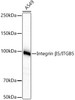 Western blot analysis of extracts from A549, using Integrin β5/ITGB5 Rabbit mAb (CAB23428) at 1:1000 dilution. Secondary antibody: HRP Goat Anti-Rabbit IgG (H+L) at 1:10000 dilution. Lysates/proteins: 25μg per lane. Blocking buffer: 3% nonfat dry milk in TBST.