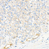 Immunohistochemistry analysis of paraffin-embedded rat stomach using Plectin Rabbit mAb (CAB23479) at dilution of 1:1000 (40x lens). Perform high pressure antigen retrieval with 10 mM citrate buffer pH 6. 0 before commencing with IHC staining protocol.